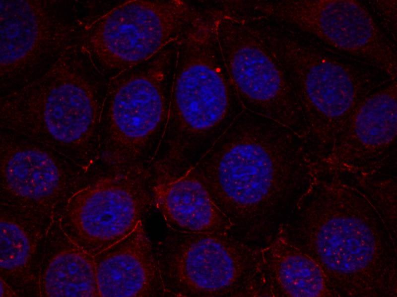 Anti-Phospho-IGF1R/CD221 (Tyr1165, 1166) Polyclonal Antibody