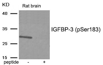 Anti-Phospho-IGFBP-3 (Ser183) Polyclonal Antibody
