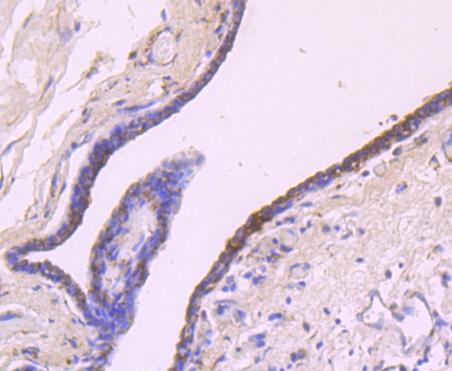 Anti-IGF2/IGF-II Antibody (5T527)
