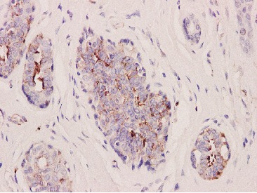 Anti-Integrin beta 3 Antibody (4P677)