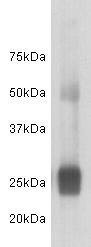 Anti-Human Iambda light chain Antibody (8V560)