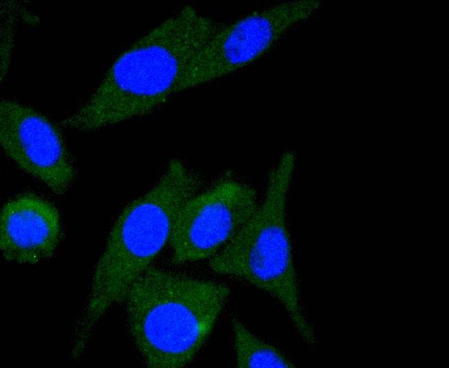 Anti-ILK Antibody (9I91)