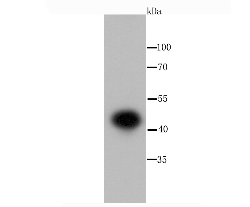 Anti-IKK- gamma Antibody (1A787)