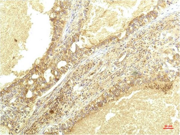 Anti-IL-8/CXCL8 Antibody (4V540)