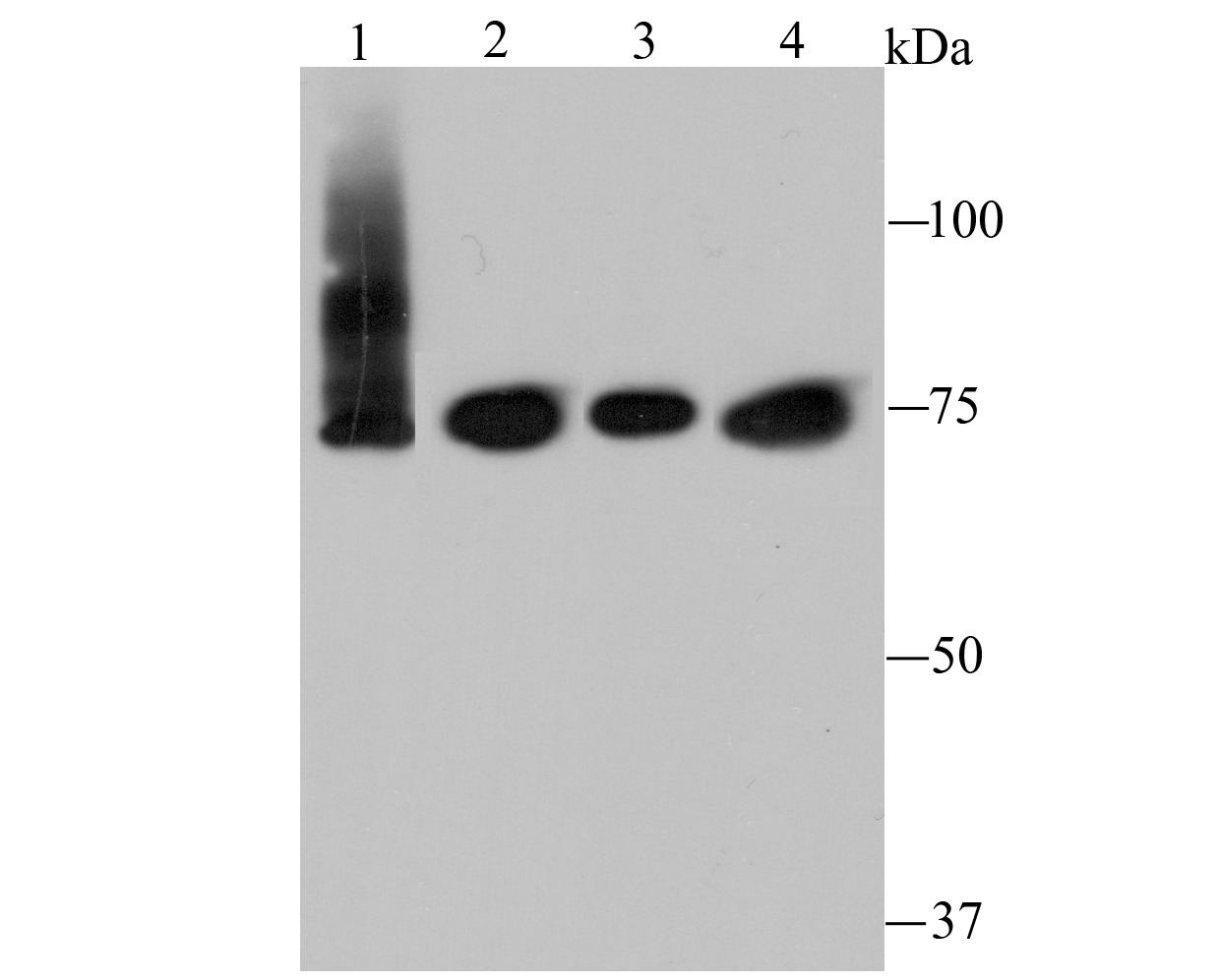 Anti-IKBKE Antibody (6N528)