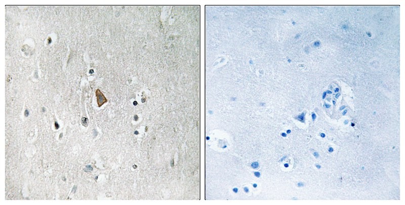 Anti-Phospho-IGF1R/CD221 (Tyr1346) Polyclonal Antibody 2