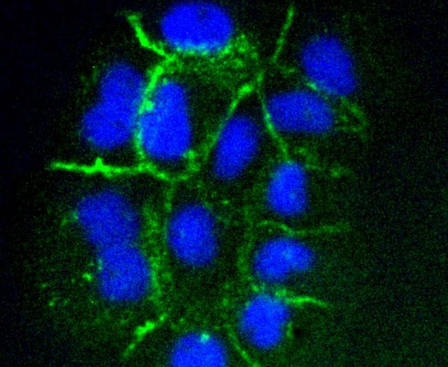 Anti-ICAM-1/CD54 Antibody (2M737)