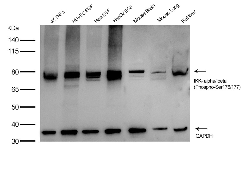 Anti-Phospho-IKBKA/IKBKB (Ser176/177) Polyclonal Antibody