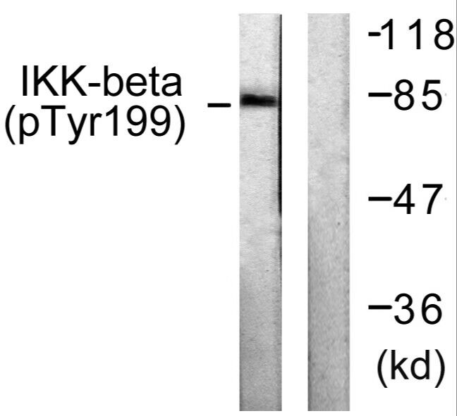 Anti-Phospho-IKBKB (Tyr199) Polyclonal Antibody 2