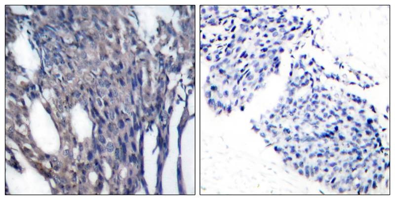 Anti-Phospho-NFKBIA (Tyr42) Polyclonal Antibody
