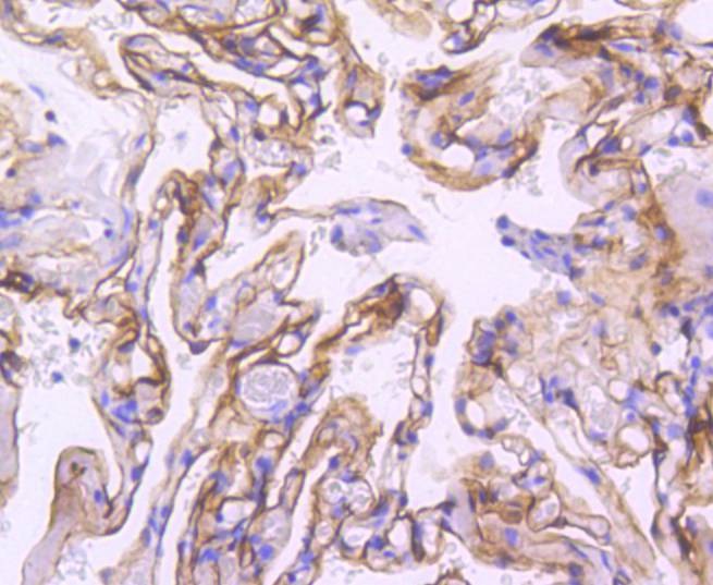 Anti-ICAM-1/CD54 Antibody (2M737)