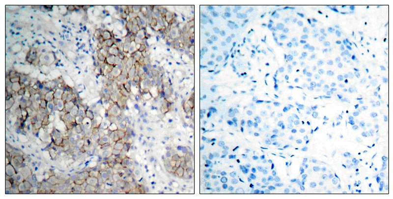 Anti-Phospho-IGF1R/CD221 (Tyr1161) Polyclonal Antibody 2