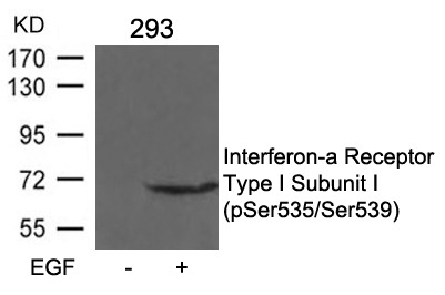 Anti-Phospho-IFNAR1 (Ser535/539) Polyclonal Antibody