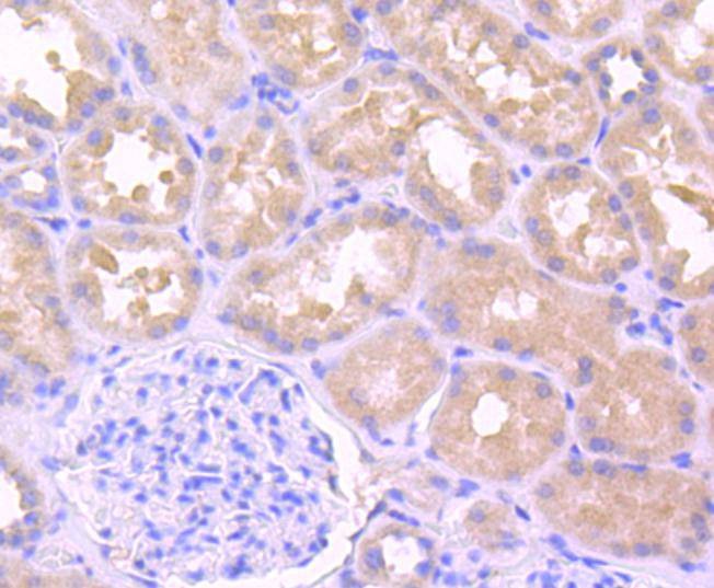 Anti-IL-1 beta/IL-1F2 Antibody (7U755)