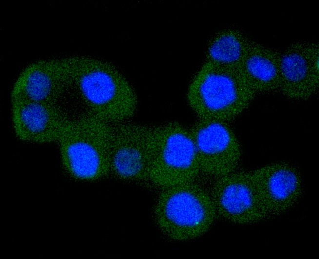 Anti-IKBKA Antibody (4P589)