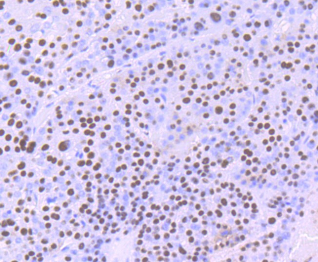 Anti-ILF2 Antibody (6A56)