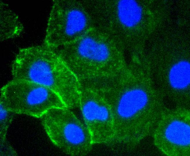 Anti-ICAM-1/CD54 Antibody (2M737)
