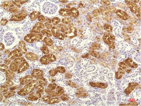 Anti-IL-8/CXCL8 Antibody (4V540)