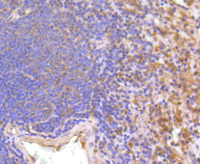 Anti-IFNAR1 Antibody (1R657)
