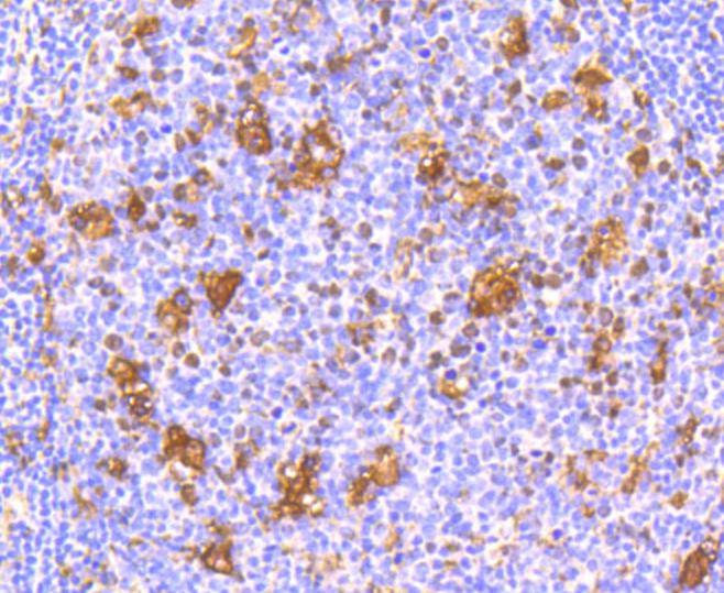 Anti-IFNAR1 Antibody (1R657)