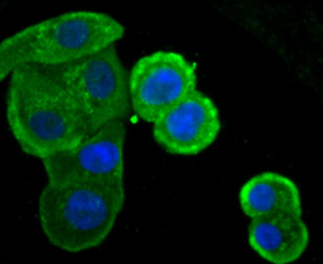 Anti-IKBKE Antibody (6N528)
