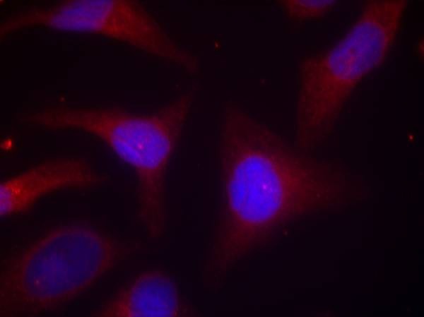 Anti-Phospho-NFKBIA (Ser32, 36) Polyclonal Antibody