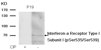 Anti-Phospho-IFNAR1 (Ser535/539) Polyclonal Antibody