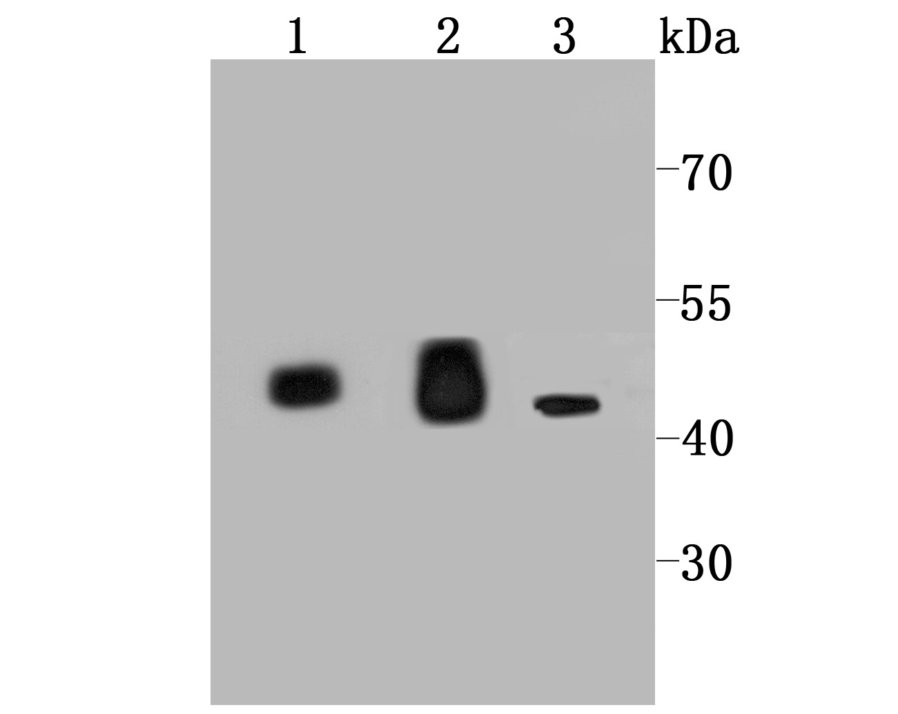 Anti-IDH2 Antibody (3T725)