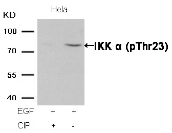 Anti-Phospho-IKBKA (Thr23) Polyclonal Antibody