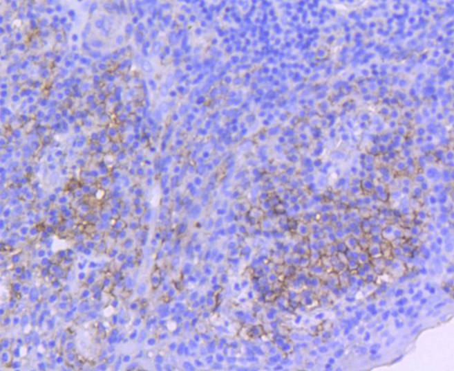 Anti-ICAM-1/CD54 Antibody (2M737)