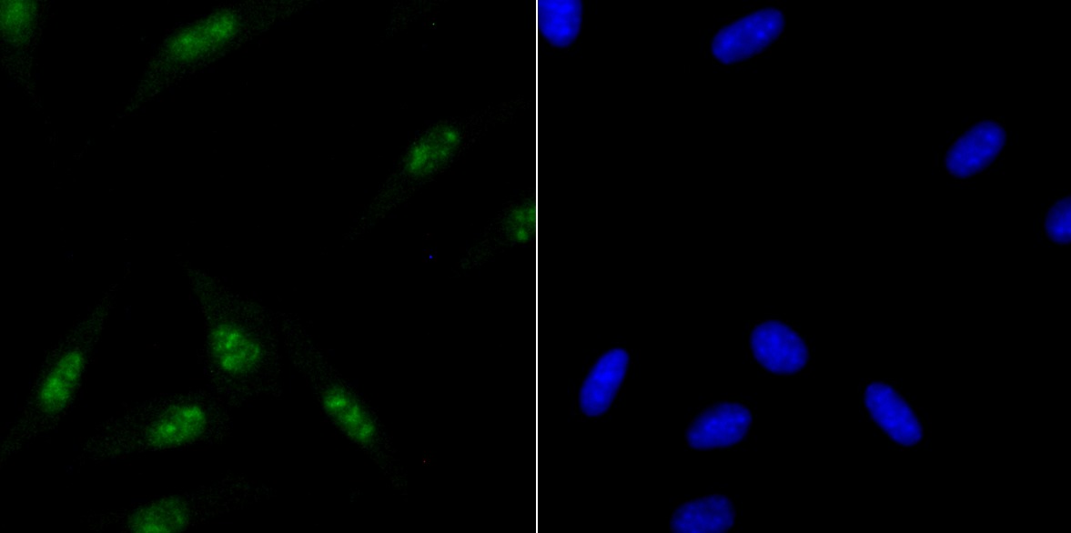 Anti-ILF3 Antibody (8T791)
