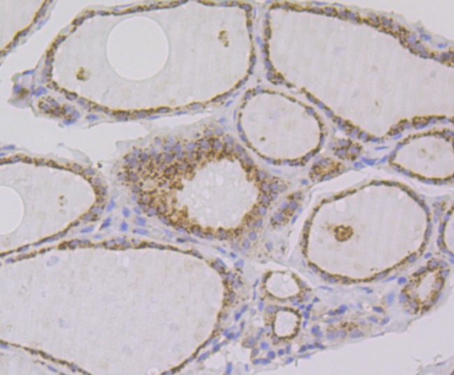 Anti-IMPDH2 Antibody (7R923)