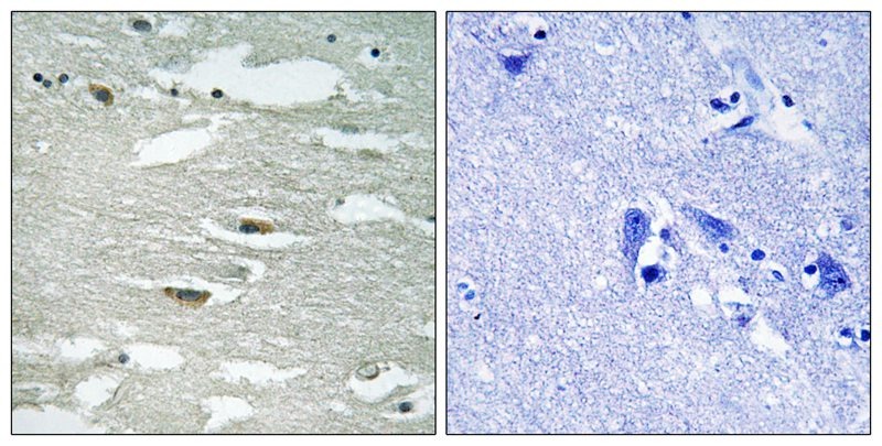 Anti-Phospho-ILK (Ser246) Polyclonal Antibody