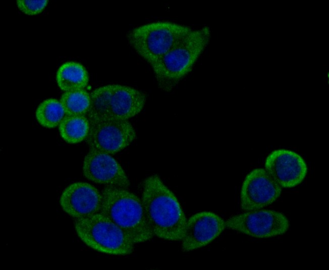 Anti-IMPDH2 Antibody (7R923)