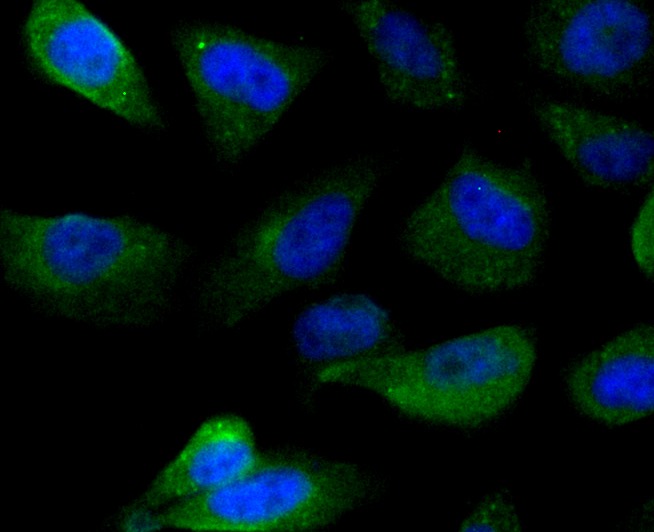 Anti-IMPDH2 Antibody (7R923)