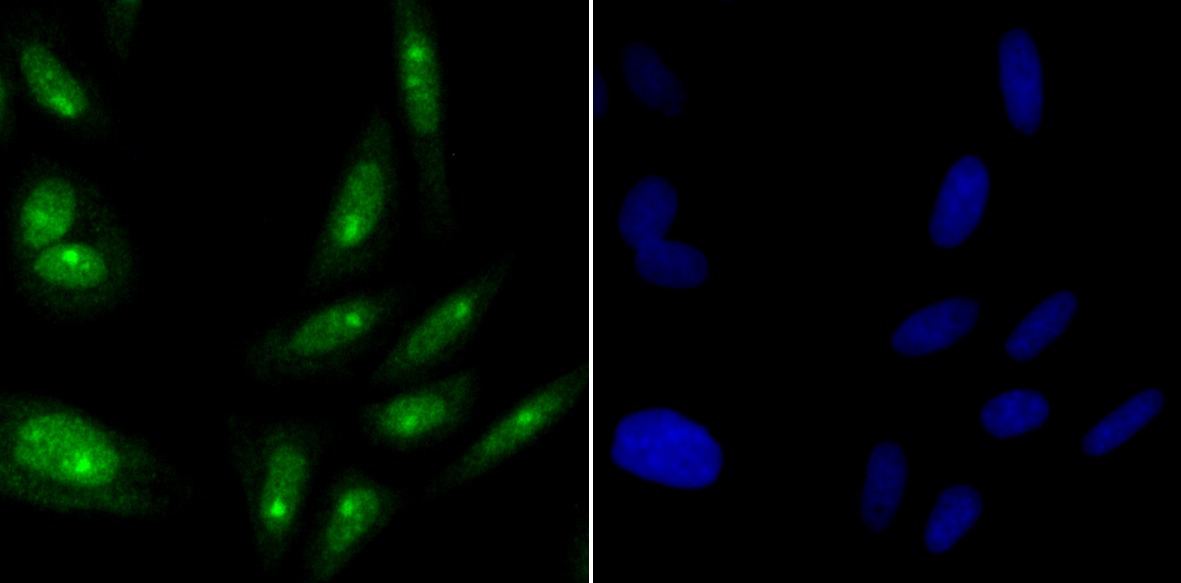 Anti-ILF3 Antibody (8T791)