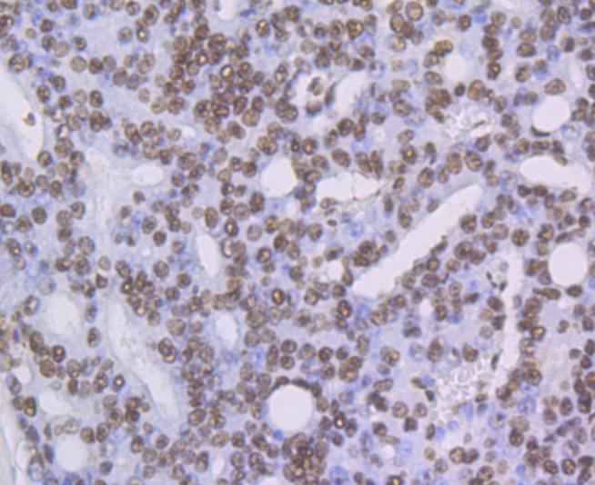 Anti-ILF3 Antibody (8T791)