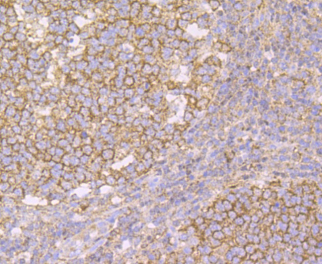Anti-IMPDH2 Antibody (7R923)