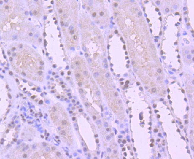 Anti-YY1 Antibody (5H894)