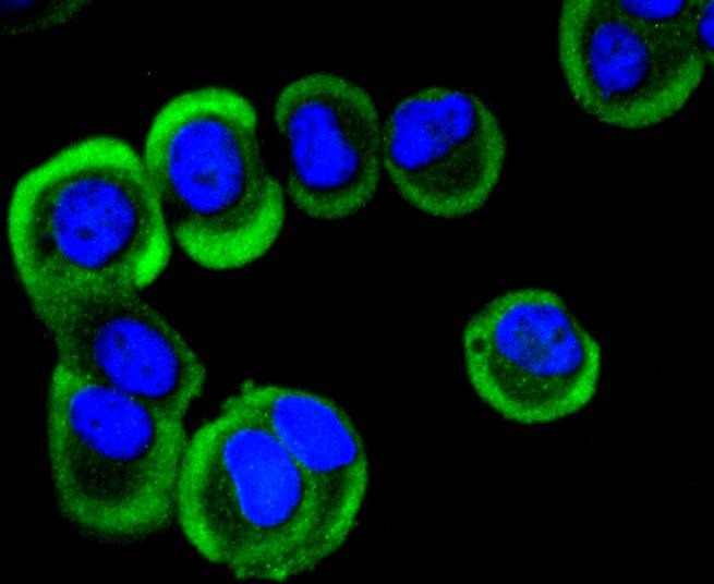 Anti-YB1 Antibody (1K676)