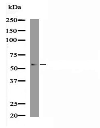 Anti-Phospho-WASP (Tyr291) Polyclonal Antibody