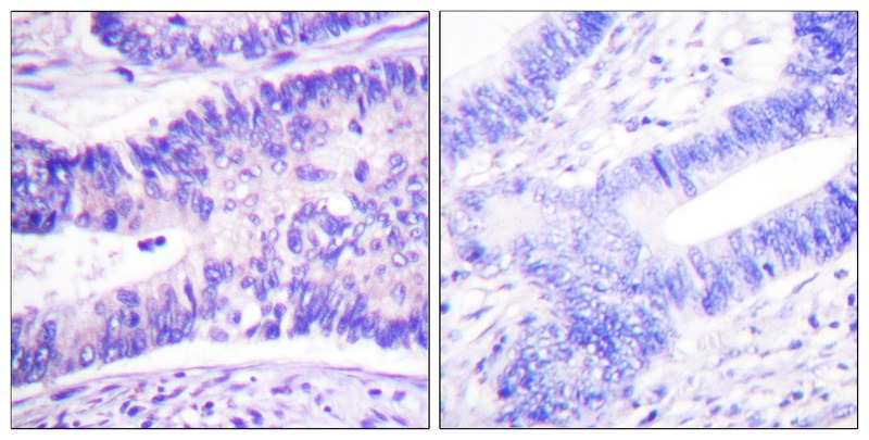Anti-Phospho-WAVE1 (Tyr125) Polyclonal Antibody