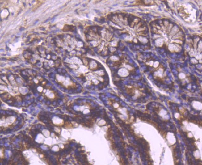 Anti-YB1 Antibody (1K676)