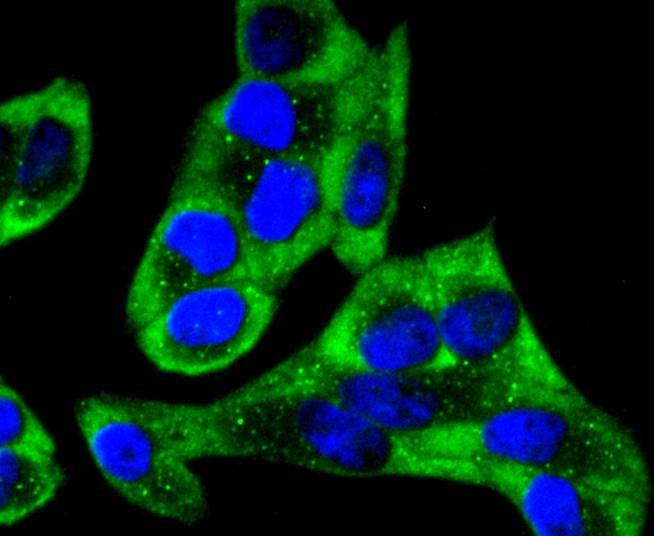 Anti-YB1 Antibody (1K676)