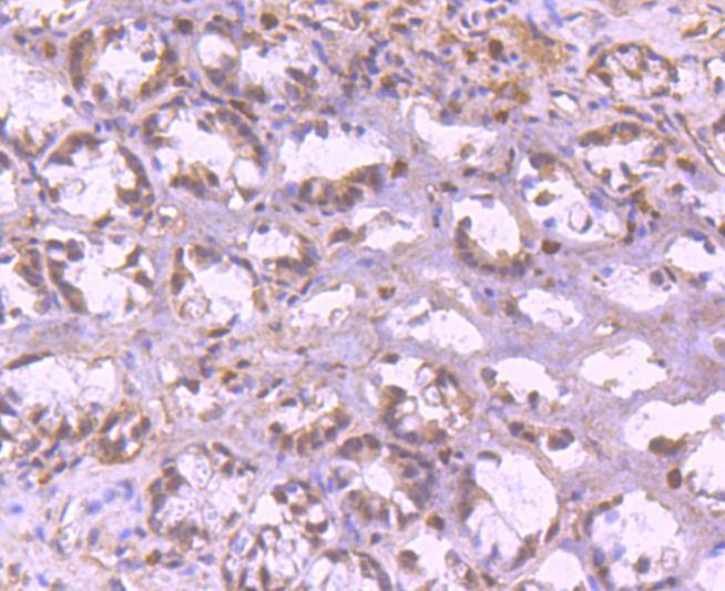 Anti-YY1 Antibody (5H894)