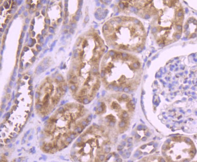 Anti-YB1 Antibody (1K676)