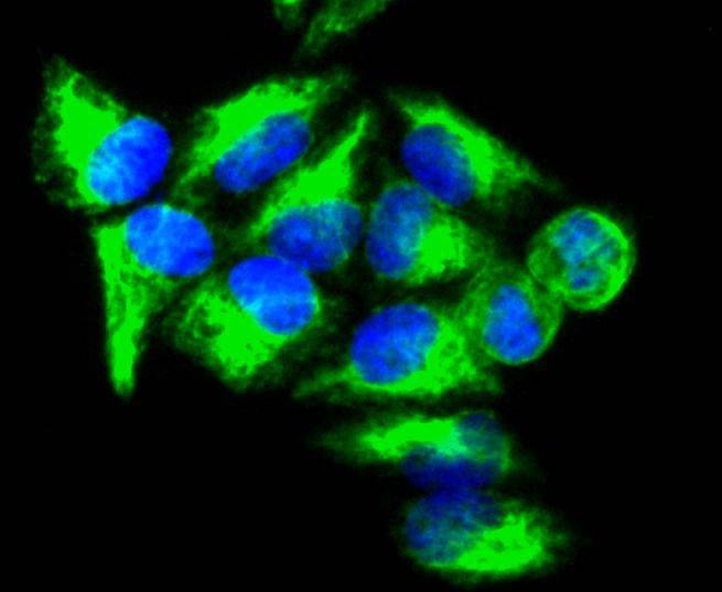 Anti-Vimentin Antibody (3N67)
