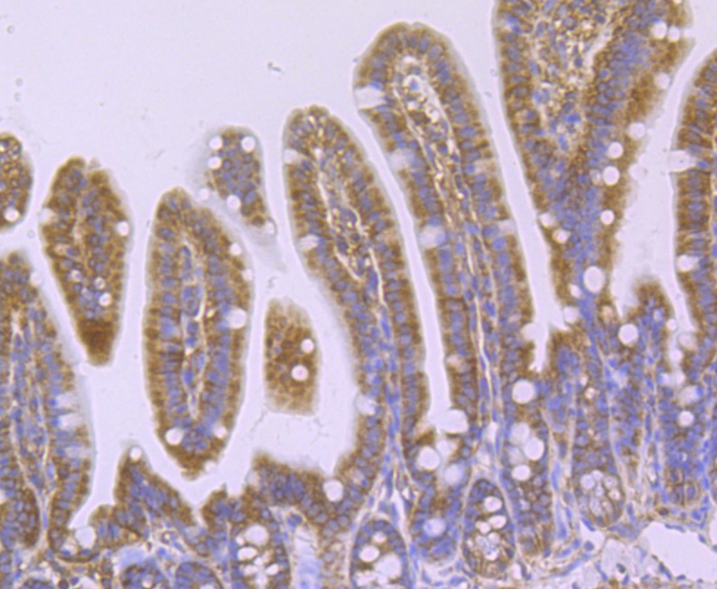Anti-WASL Antibody (8M531)
