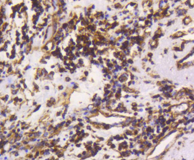 Anti-Vimentin Antibody (3N67)