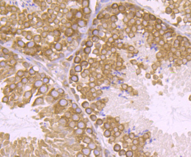 Anti-VPS26 Antibody (5Y706)